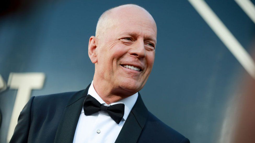 Bruce Willis diagnosticat cu afazia, nu mai poate vorbi inteligibil. „Imposibilitatea de a găsi cuvintele pentru a se exprima” 1