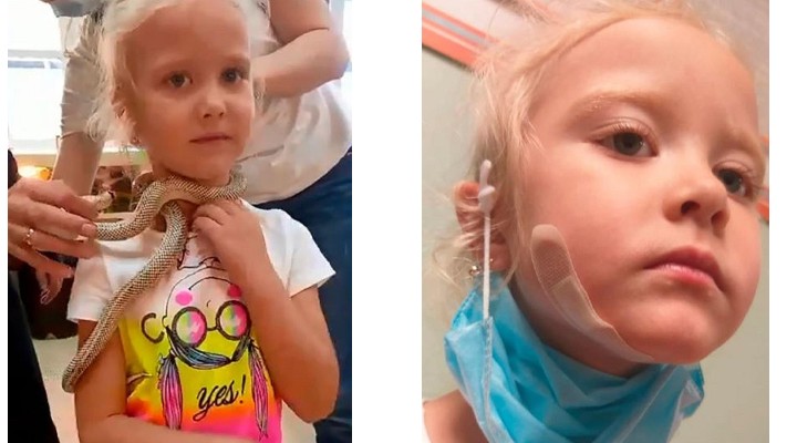(Video) O fetiţă de 5 ani a fost muşcată de faţă de un şarpe veninos, la o grădină zoologică din Rusia 1